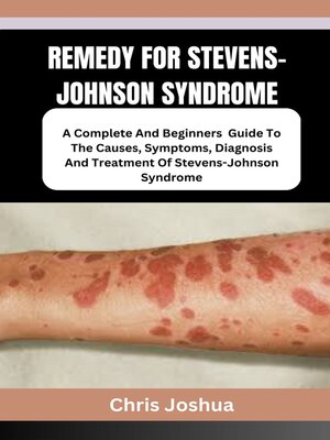 cover image of REMEDY FOR STEVENS-JOHNSON SYNDROME